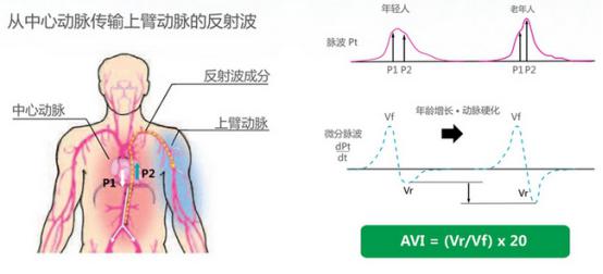 肢体动脉硬化检测仪